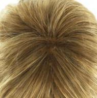 Mittelblond-mix
